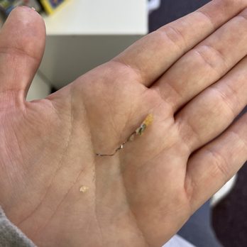 Double Dragon - a person's hand with a tiny insect on it - Chinese Near Me - Elizabethtown, Kentucky
