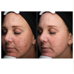 Beauty & Grace Aesthetics - Moxi