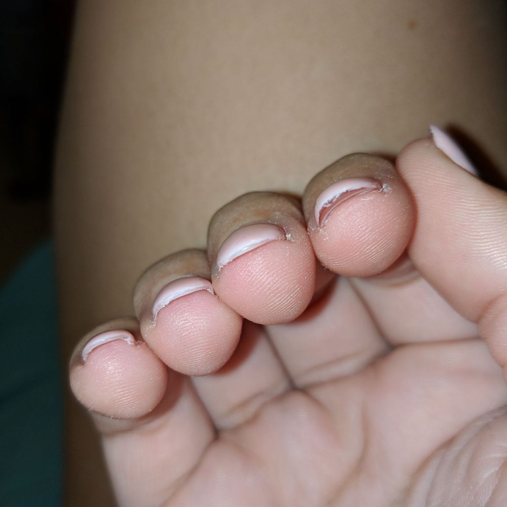 Smiley Nails - He fixed the pointer finger. It's so thick you can see the layer of acrylic perfectly under the layer of paint. Also super uneven. - Nail Salons Near Me - Honolulu, Hawaii Smiley Nails - He fixed the pointer finger. It's so thick you can see the layer of acrylic perfectly under the layer of paint. Also super uneven. - Nail Salons Near Me - Honolulu, Hawaii