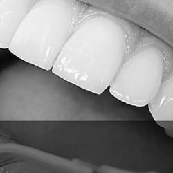 Douglasville Family Dental Center