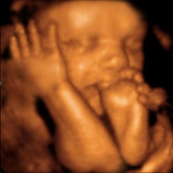 My First Selfie - What's your baby doing right now?