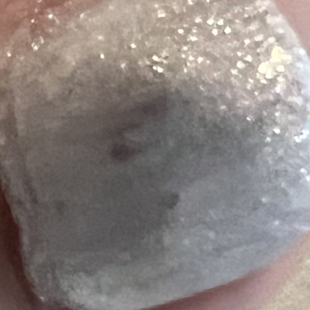 Horrible pedicure. Horrible pedicure.