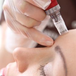 Elite Face&Body Care  - Microneedling $200-Face, add neck for $50