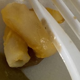 Hair in the Mac and cheese, metal in the yams. Hair in the Mac and cheese, metal in the yams.