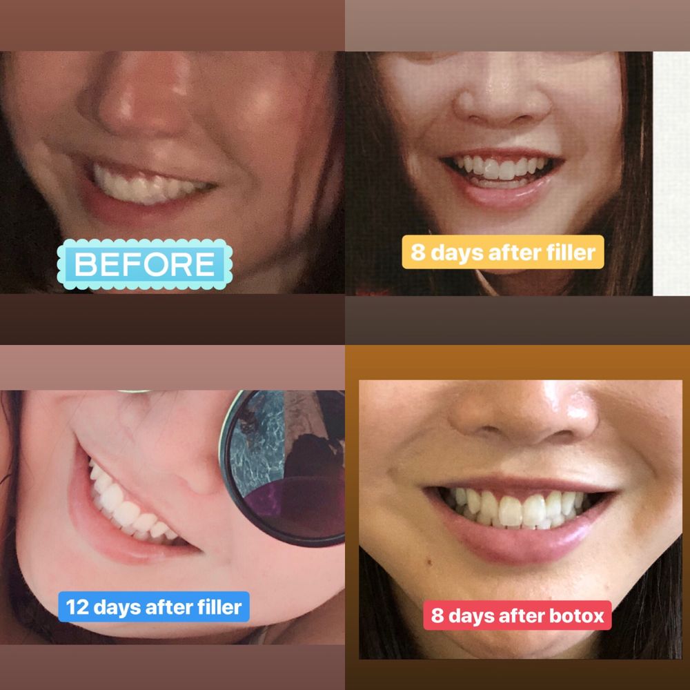 Honolulu MedSpa - No difference... very disappointed - Skin Care Near Me - Honolulu, Hawaii