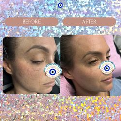 Aesthetics Care Med Spa