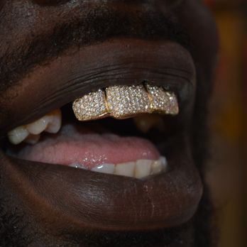 Baltimore Gold Fronts - Jewelry Near Me - Baltimore, Maryland Baltimore Gold Fronts - Jewelry Near Me - Baltimore, Maryland