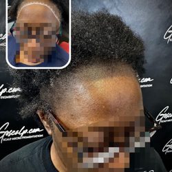 Goscalp