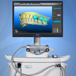 Mansfield Family Dentistry - The iTero® scanner allows Dr. Bauer to take a digital impression--a highly accurate, digital 3D image of your tooth surfaces.