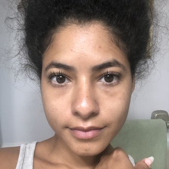 Zee's Threading & Skincare Spa - 3 days after hydra facial, lash lift, and brows. After removing makeup I wore for the first time post services. - Skin Care Near Me - Coral Springs, Florida Zee's Threading & Skincare Spa - 3 days after hydra facial, lash lift, and brows. After removing makeup I wore for the first time post services. - Skin Care Near Me - Coral Springs, Florida