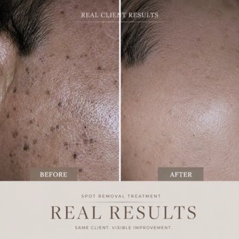 Misarang Beauty - Skin Care Near Me - Los Angeles, California Misarang Beauty - Skin Care Near Me - Los Angeles, California