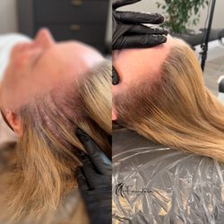 Fountain Of Youth - Natural SMP transformation in Berkeley, restoring density for women with hair loss.