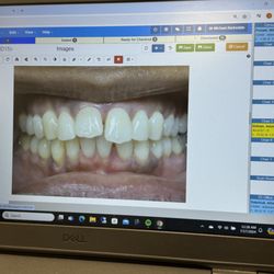 Orthodontic Associates - Owings Mills - Before