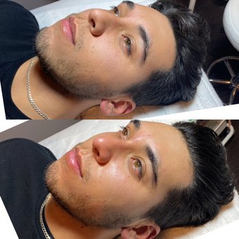 CYN COCO - Men's facial - Estheticians Near Me - Lodi, California CYN COCO - Men's facial - Estheticians Near Me - Lodi, California