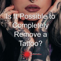 Regerts Ink Removal - Send us a message for info