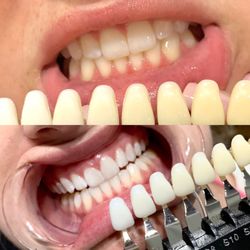 Honey Dipped - High performance whitening lifted 8+ shades!