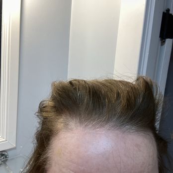 Scalp New England - Hair Loss Centers Near Me - Peabody, Massachusetts