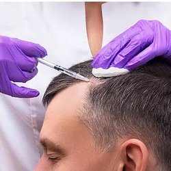 Needles & Tox - Hair Restoration