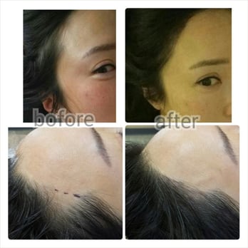 3d Hairline Tattoo By Tami Yelp