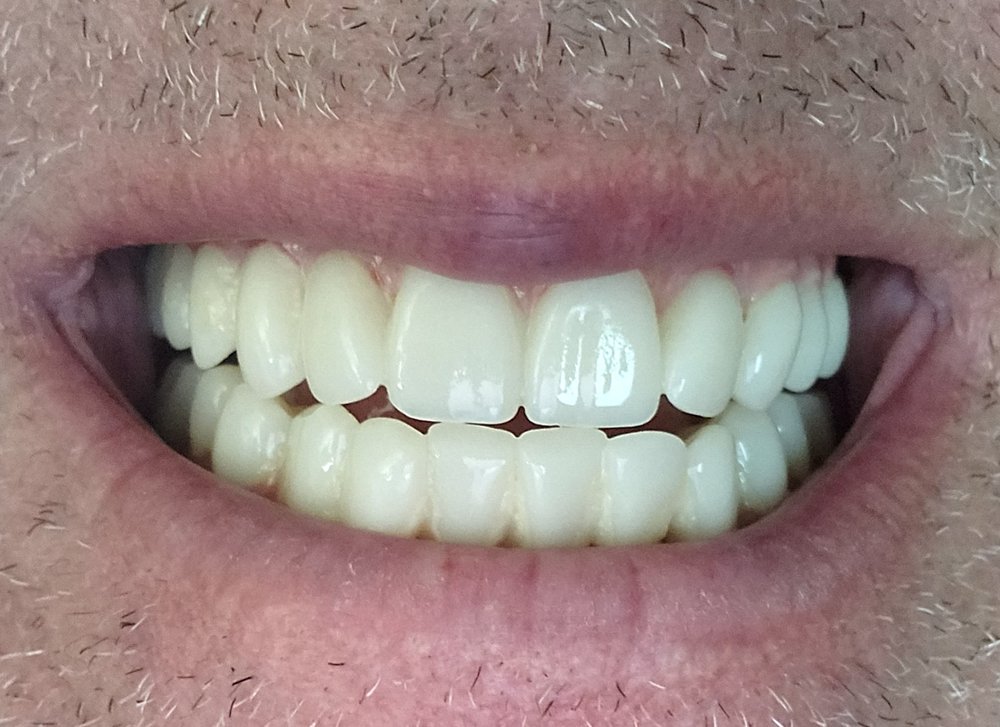 ADVANCED DENTAL IMPLANT CENTER Updated October 2024 4010 Sandy