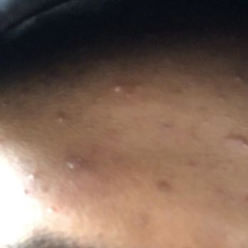 Amina Spa - Bumps - Waxing Near Me - Las Vegas, Nevada