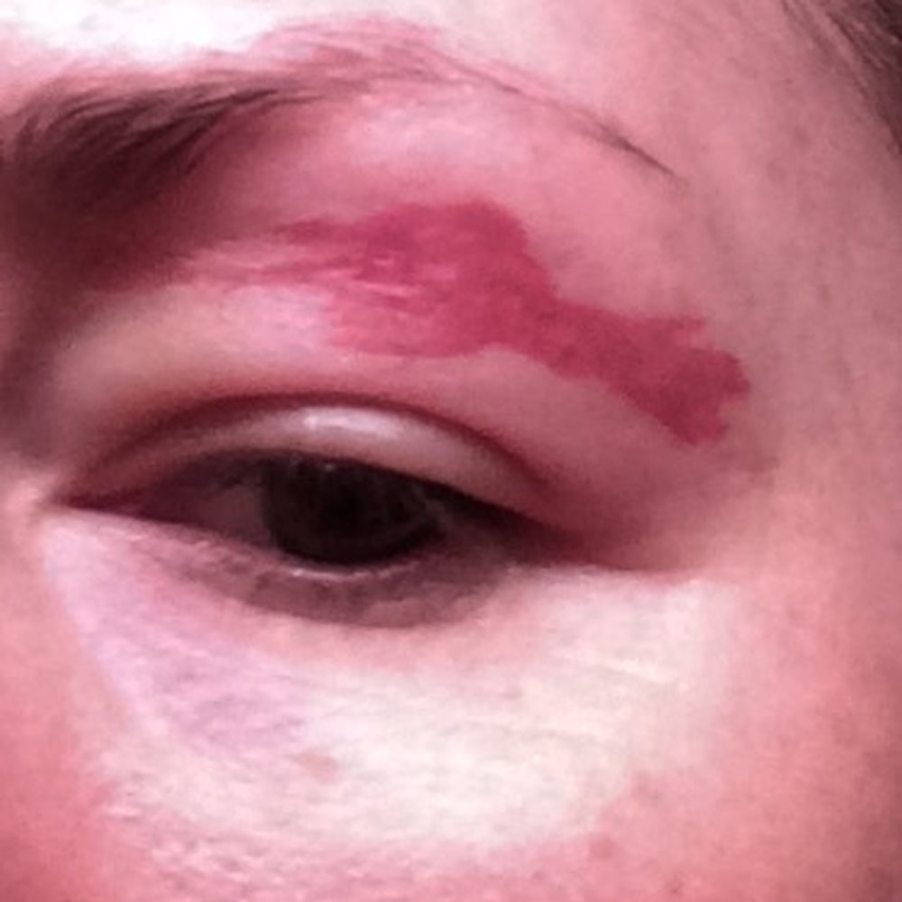 Mod Nail & Spa - Burn from eyebrow wax - Nail Salons Near Me - Spring, Texas
