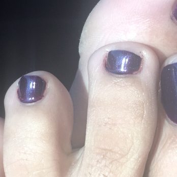 Jasmine Nail Spa - $35 pedicure that looks like this. Smh. Never again. - Nail Salons Near Me - San Leandro, California Jasmine Nail Spa - $35 pedicure that looks like this. Smh. Never again. - Nail Salons Near Me - San Leandro, California