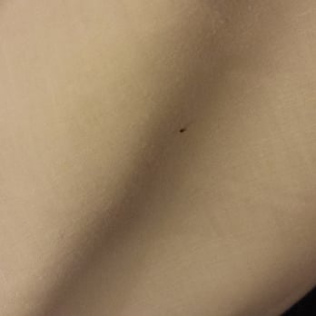 Rodeway Inn & Suites - Unless your ready to sleep with dirty sheets. Tons of bed bugs do NOT stop here. Terrible experience. - Hotels Near Me - Flagstaff, Arizona Rodeway Inn & Suites - Unless your ready to sleep with dirty sheets. Tons of bed bugs do NOT stop here. Terrible experience. - Hotels Near Me - Flagstaff, Arizona