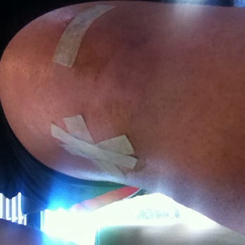 Phoenix Shoulder and Knee - Knee - Orthopedists Near Me - Tempe, Arizona