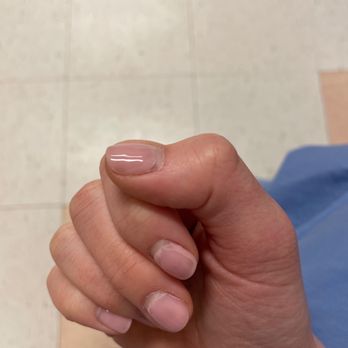 Prestige Nail Salon - After only 1 week all my gel nails are heavily peeling off - Nail Salons Near Me - Philadelphia, Pennsylvania Prestige Nail Salon - After only 1 week all my gel nails are heavily peeling off - Nail Salons Near Me - Philadelphia, Pennsylvania