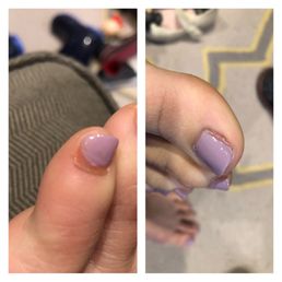 Terrible pedicure Terrible pedicure