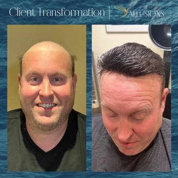 Allusions Hair Replacement Studio - Hair Loss Centers Near Me - Cincinnati, Ohio
