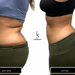 Lovesculpt