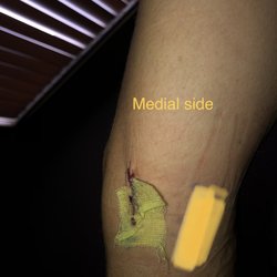George Kardashian, M.D. - Medial side