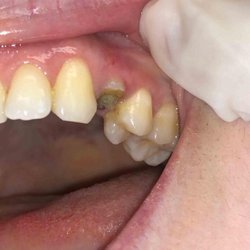 Beyond Dentistry Laser Center