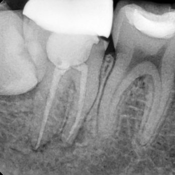 Everett Dental Care - General Dentistry Near Me - Everett, Washington Everett Dental Care - General Dentistry Near Me - Everett, Washington