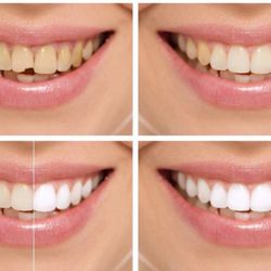 Farmington Hills Family Dentistry
