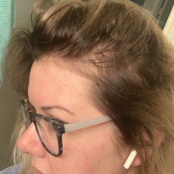 High Octane Cuts - Hair loss from over processing - Waxing Near Me - Harlingen, Texas
