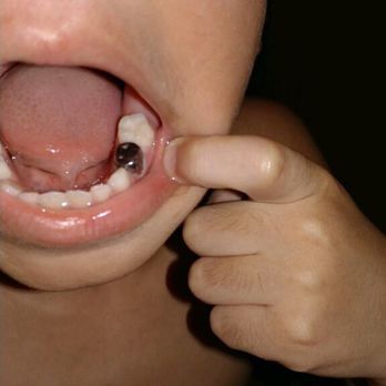 Apple Dental Care - Pediatric Dentists Near Me - Chicago, Illinois Apple Dental Care - Pediatric Dentists Near Me - Chicago, Illinois