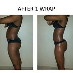 Symmetry Medical Spa - WE HAVE VERY AFFORABLE BODY WRAP DEALS!!!