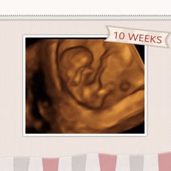 Cherished Memories - 10 weeks in 4D!
