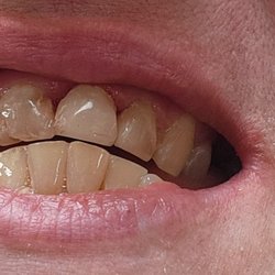 Fox Kenneth, DDS - After : more work to be done still