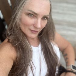BodyLase Med Spa - Few weeks after lip fillers