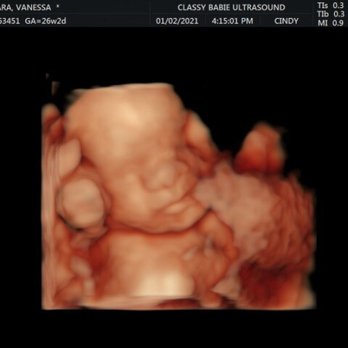 Classy Babie - Ultrasound Imaging Centers Near Me - Inglewood, California Classy Babie - Ultrasound Imaging Centers Near Me - Inglewood, California