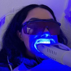 Seattle Teeth Whitening