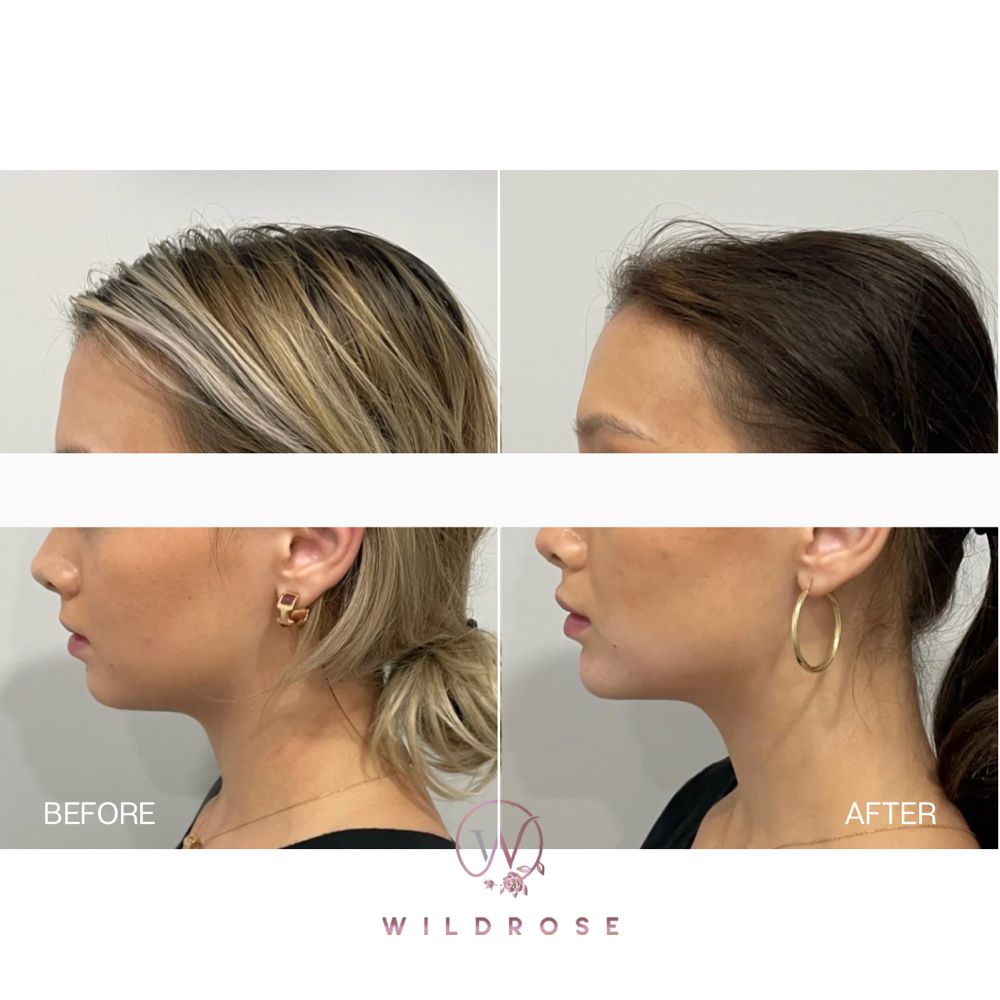 Wildrose Aesthetics Logo