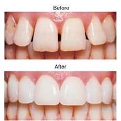 Mesa Dental Center