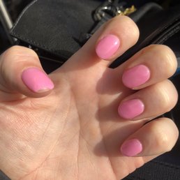 Chipped nail and uneven texture. Chipped nail and uneven texture.