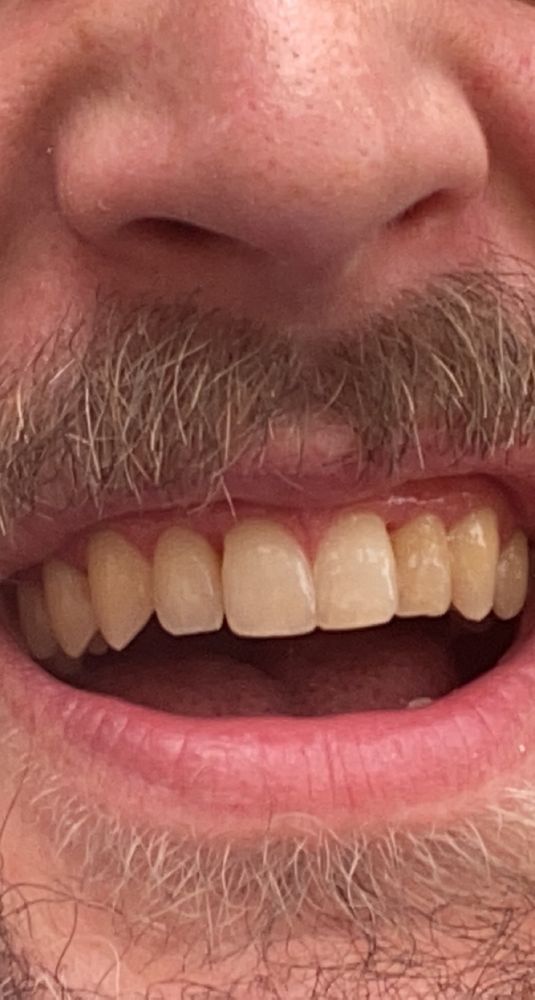 ADVANCED DENTAL CARE OF CITRUS PARK Updated September 2024 14 Reviews 7867 Gunn Hwy, Tampa