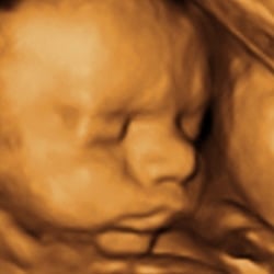 My First Peekaboo